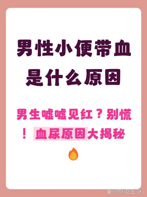 梦见血尿是什么兆头_2
