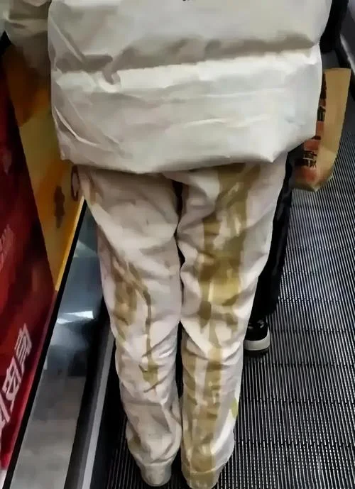 梦见浑身是屎_1