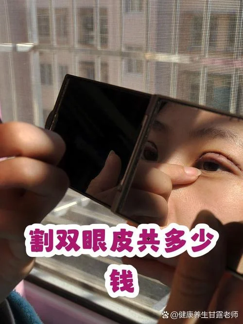 上海开双眼皮多少钱_1