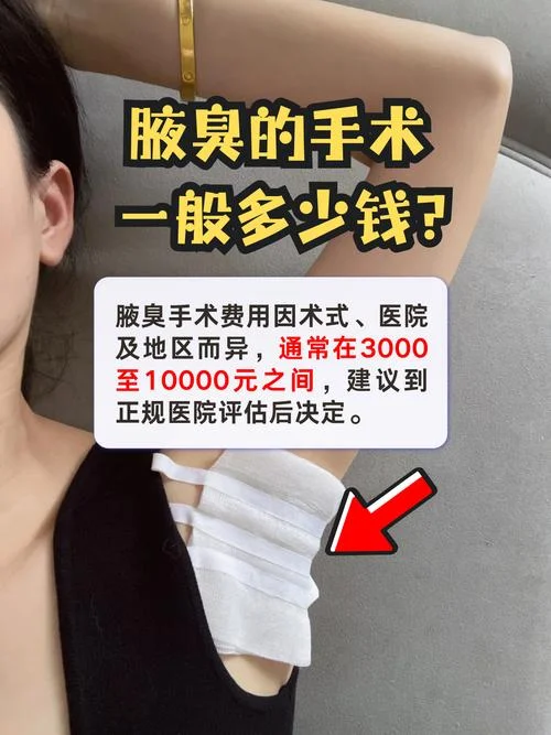 去腋臭微创多少钱_2