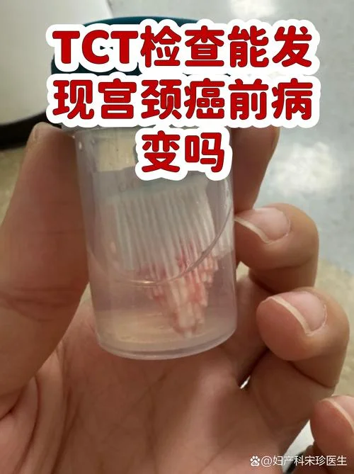 做宫颈tct多少钱_1