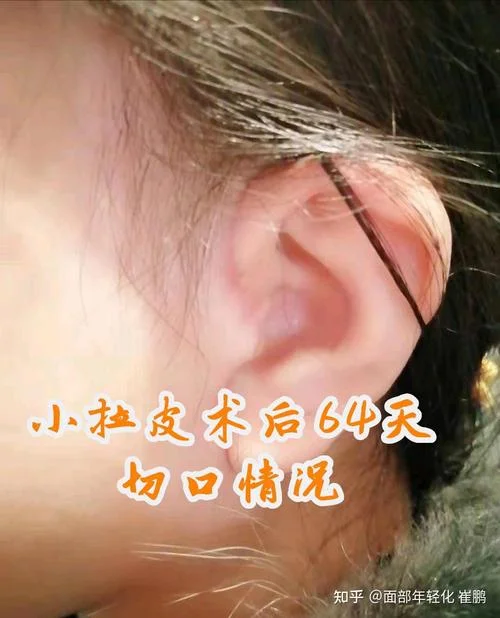 丰胸膏滋的原理是什么_1