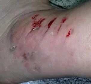 梦见别人身上都是血是什么预兆解梦_1