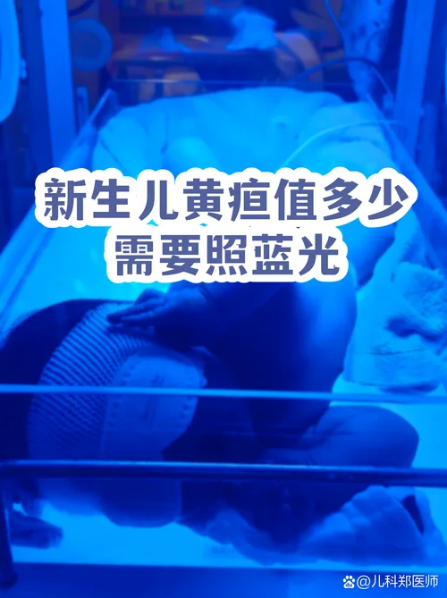 新生儿黄疸检查多少钱_1