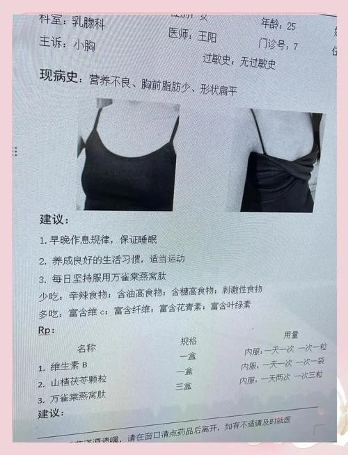 丰胸秘方_1