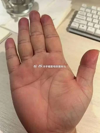 手相刀子纹长的这么样_2
