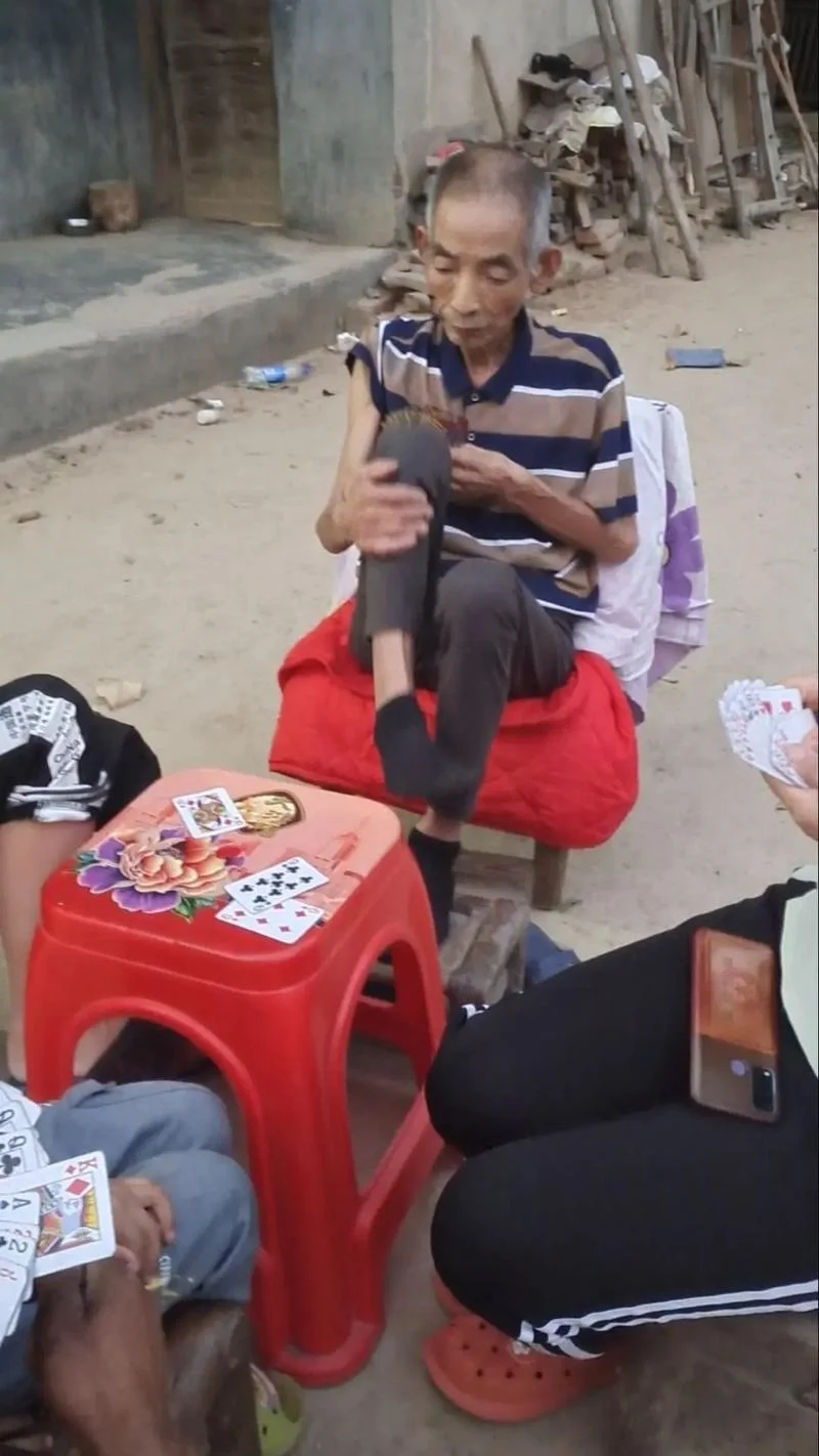 梦见父亲手坏了_1