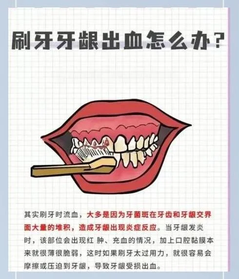 牙缝出血有臭味怎么办_1