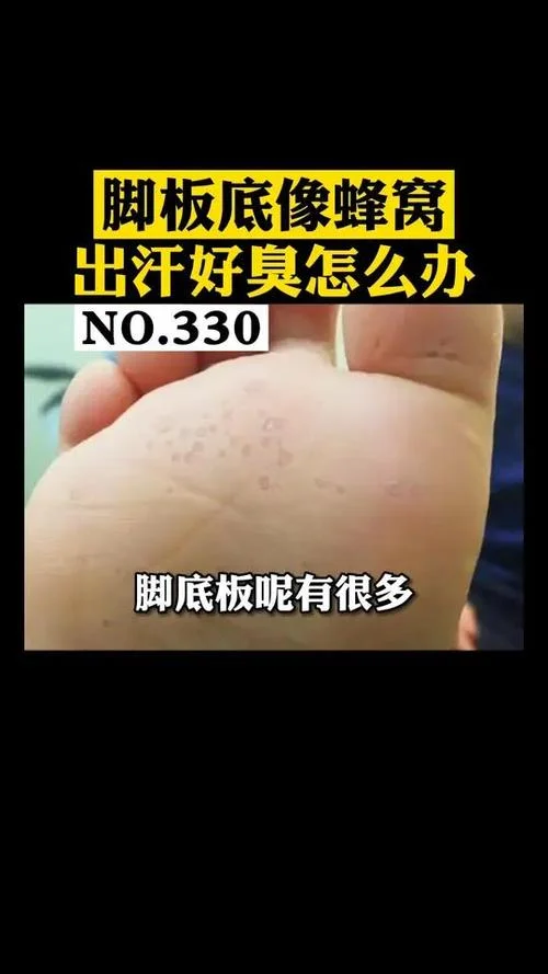 做梦梦到自己脚底空了_1