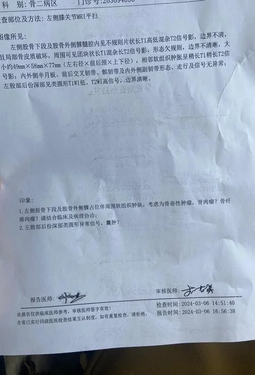 骨癌化疗一疗程多少钱_1