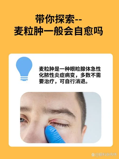 麦粒肿痊愈的过程原理-麦粒肿自然消退机制