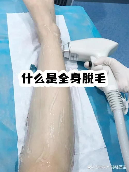 四肢脱毛一般要多少钱_1