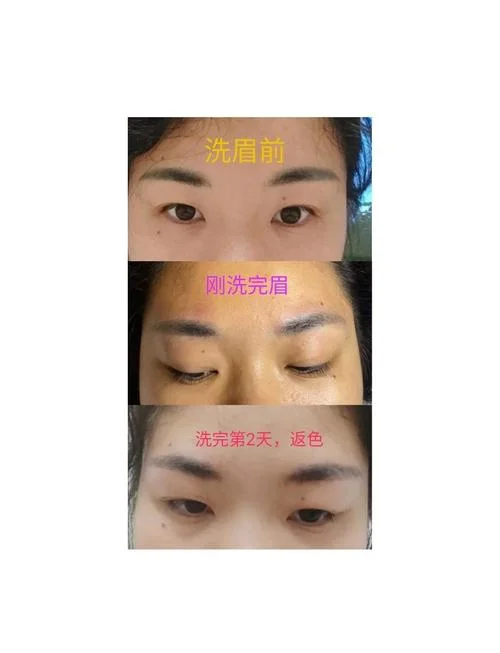 洗眉多少钱-洗眉费用查询 10 字