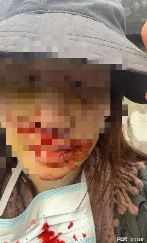 梦到别人出车祸看见血_1