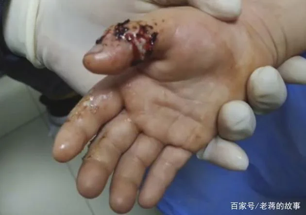 梦见狼咬手_2