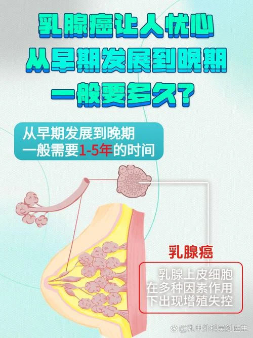 乳腺癌靶向治疗是什么意思-乳腺癌靶向治疗指意义