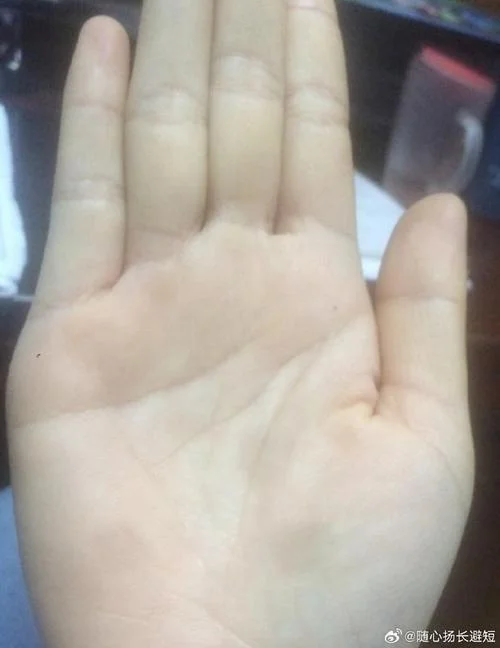 手相身体发生不好情况-手相身体易出问题