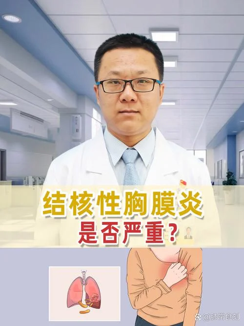 什么人得结核性胸膜炎-结核性胸膜炎易感人群