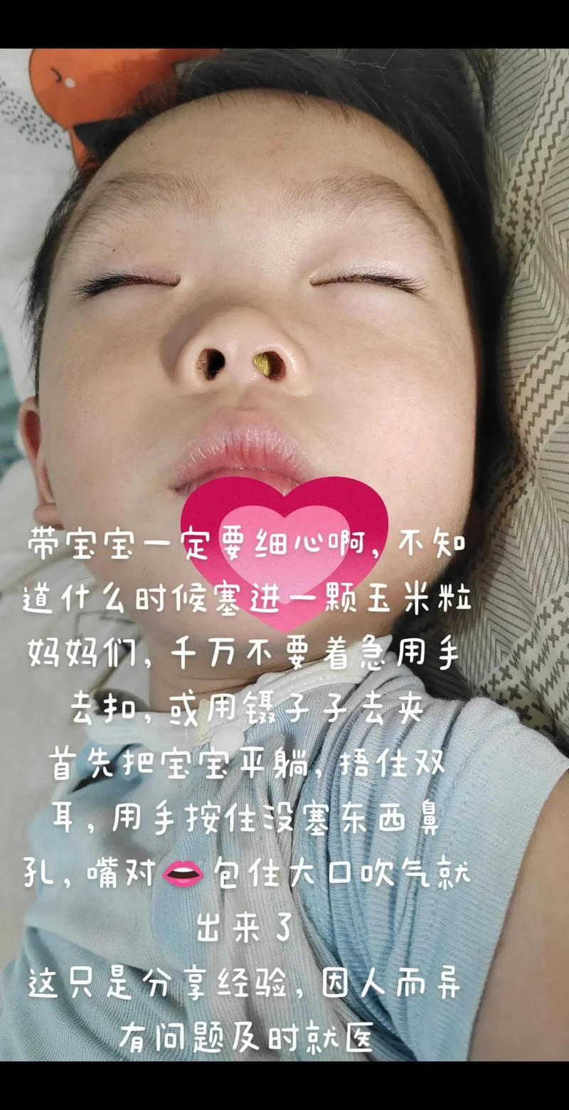 婴幼儿鼻子塞怎么办-宝宝鼻塞别急