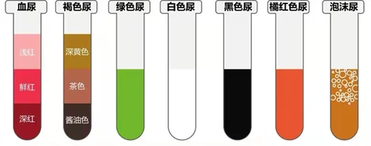 梦见别人喝自己的尿是什么意思_1