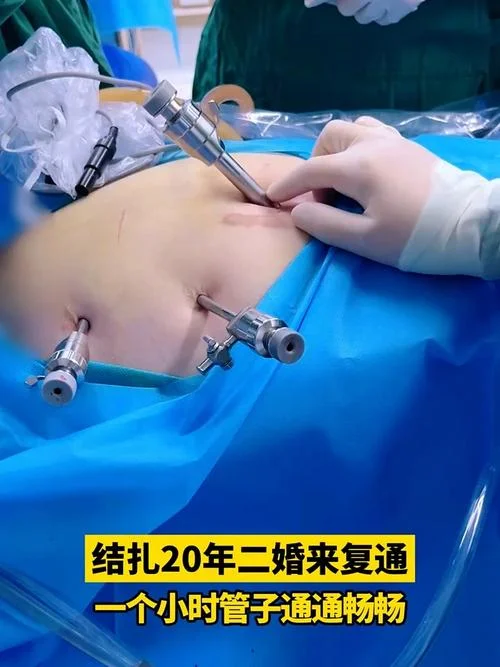 梦见自己结扎了_1