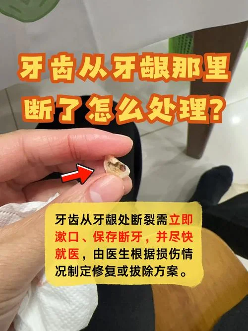 梦见牙齿断裂怎么修复_2