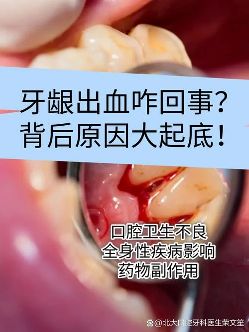 梦见自己大牙掉了出血怎么回事_1