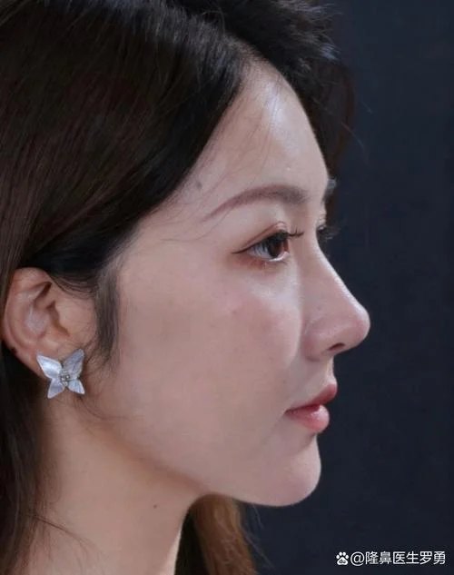 鼻梁直的女人面相_1