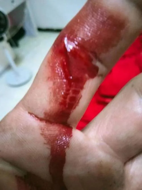 梦见别人头掉了流血了_2