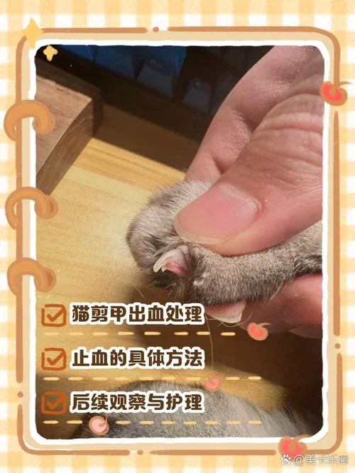 梦见剪手指甲剪出血_1