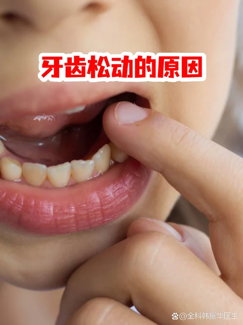 梦见上牙齿松动-梦醒上牙松动