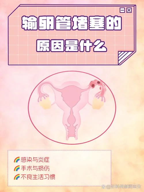 如何查输卵管炎不通-查输卵管炎是否通畅