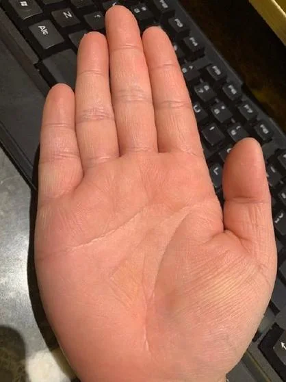 手心凸起的手相_2