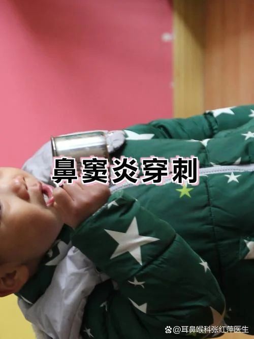 鼻子穿刺多少钱_2