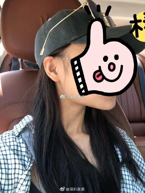 北京磨骨要多少钱_1