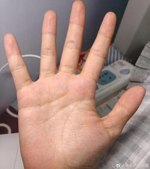 手相身体发生不好情况_1