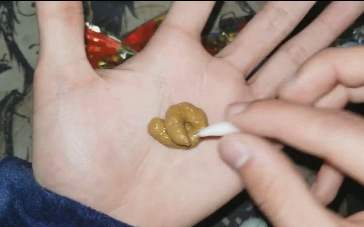 梦见自己手上有屎_1