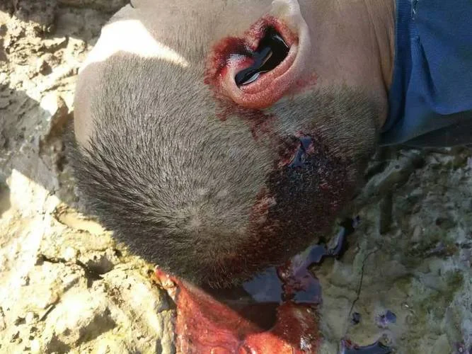 梦见我把人打死_1