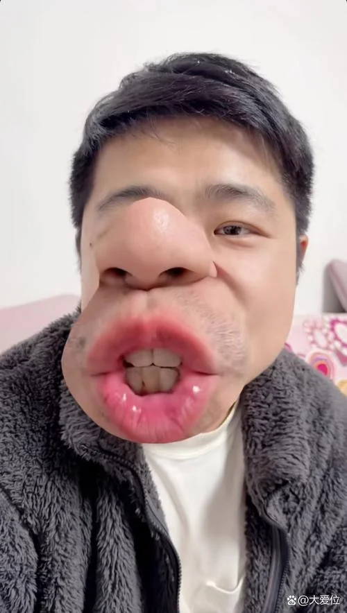 鸟嘴的男人的面相_1