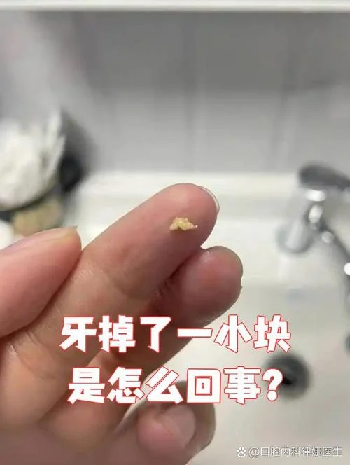 梦到自己的烤瓷牙掉了_2
