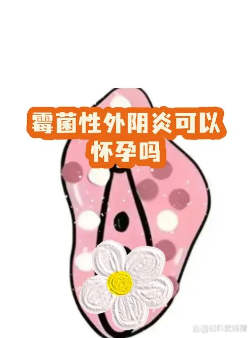 怀孕霉菌性阴炎反复怎么办_1