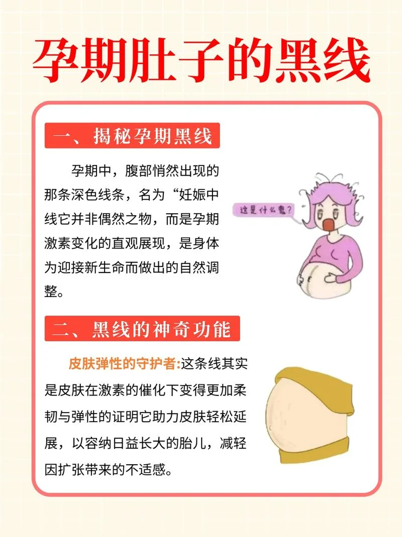 妊娠纹管理项目_1