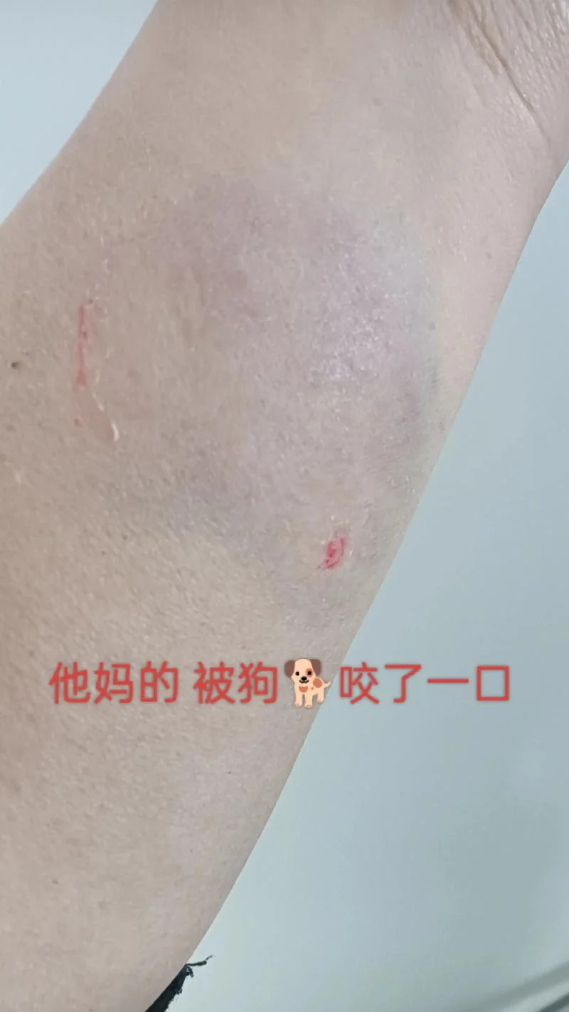 梦到狗咬我臀部_2