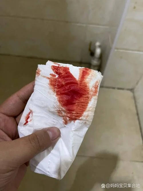 梦见自己怀孕下面流血_2
