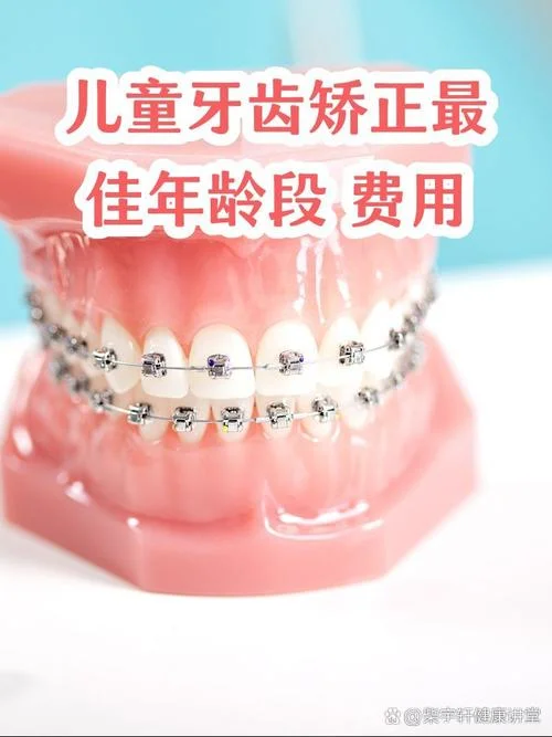 上牙矫正一般要多少钱_1