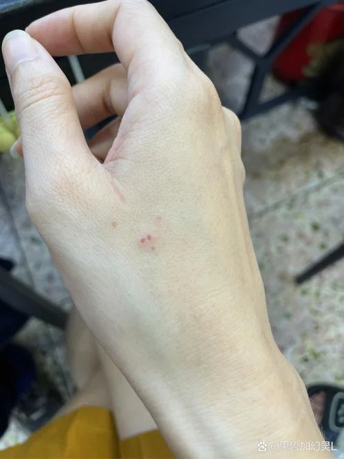 女人梦见老鼠咬手不放_1