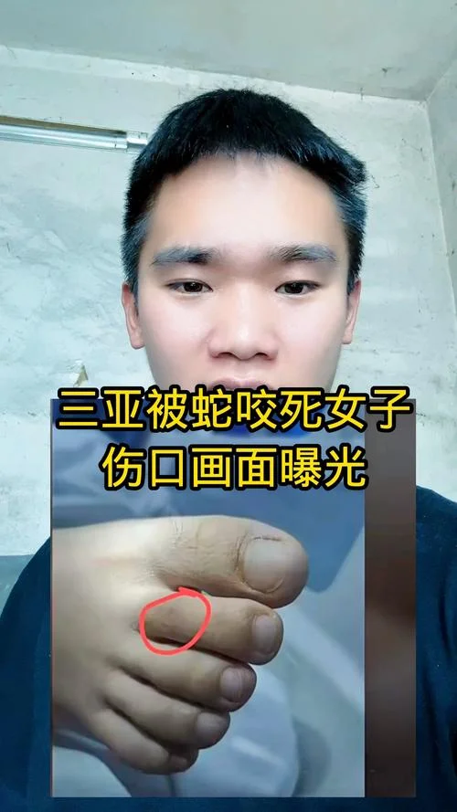 梦见被蛇追咬了-梦见蛇追咬