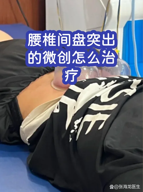 微创治疗_2