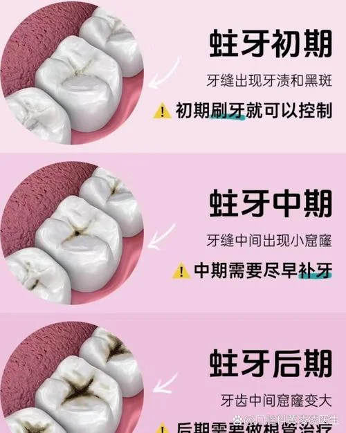 梦见蛀牙松动自己拔掉_2