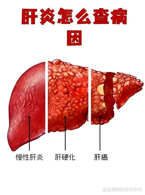 如何查肝_2